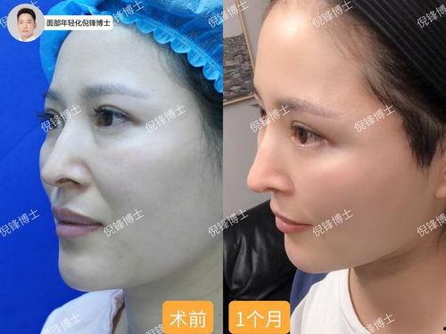 小拉皮视频,揭秘短视频背后的魅力与影响力